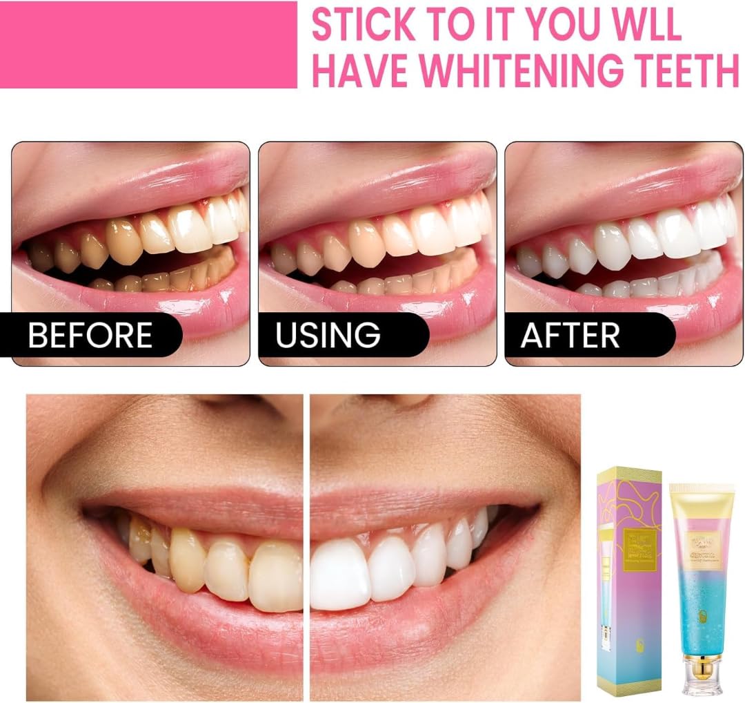URBANOMAX Niacinamide whitening toothpaste tube with mint flavor and clean, brightening teeth in a close-up shot