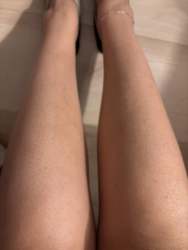 Emily R., USA